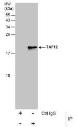TAF12 Antibody in Immunoprecipitation (IP)