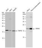 TAF12 Polyclonal Antibody