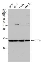 TBCA Polyclonal Antibody