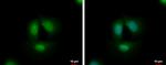 TCF3 Polyclonal Antibody