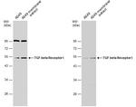 TGFBR1 Polyclonal Antibody