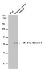 TGFBR2 Polyclonal Antibody