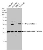 TMOD1 Antibody in Western Blot (WB)