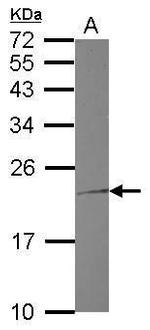 Troponin I Polyclonal Antibody
