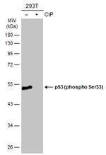Phospho-p53 (Ser33) Antibody in Western Blot (WB)