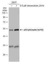 Phospho-p53 (Ser46) Antibody in Western Blot (WB)