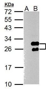 TWIST1 Polyclonal Antibody