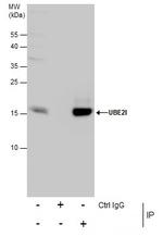 UBC9 Antibody in Immunoprecipitation (IP)