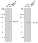 UBF-1 Polyclonal Antibody