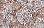 Uteroglobin Polyclonal Antibody