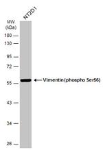 Phospho-Vimentin (Ser56) Antibody in Western Blot (WB)