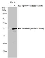 Phospho-Vimentin (Ser56) Antibody in Western Blot (WB)