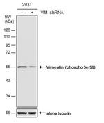 Phospho-Vimentin (Ser56) Antibody in Western Blot (WB)