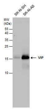 VIP Antibody in Western Blot (WB)