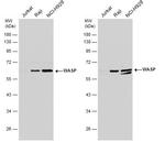 WASP Antibody in Western Blot (WB)
