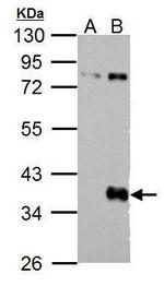 WNT9B Polyclonal Antibody