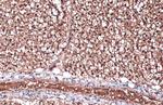 ZIC1 Polyclonal Antibody