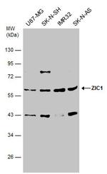 ZIC1 Antibody in Western Blot (WB)