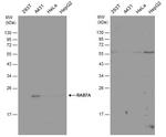 RAB7A Antibody in Western Blot (WB)