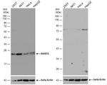 RAB7A Antibody in Western Blot (WB)