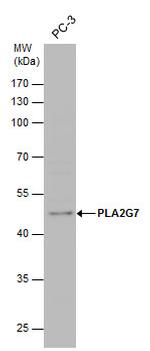 PLA2G7 Polyclonal Antibody