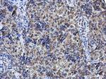 SHOC2 Polyclonal Antibody