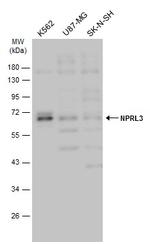 NPRL3 Antibody in Western Blot (WB)