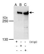 TRRAP Antibody in Immunoprecipitation (IP)
