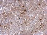 AXIN2 Polyclonal Antibody