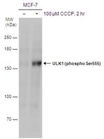 Phospho-ULK1 (Ser555) Polyclonal Antibody