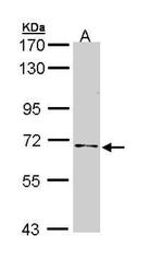 NUMB Antibody in Western Blot (WB)
