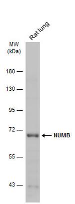 NUMB Antibody in Western Blot (WB)