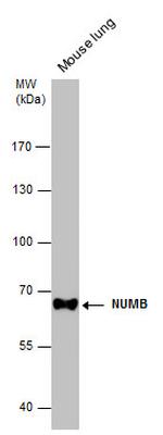 NUMB Antibody in Western Blot (WB)