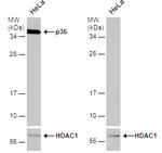p35 Antibody in Western Blot (WB)