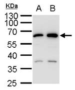 SQSTM1 Polyclonal Antibody