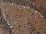 WAVE1 Antibody in Immunohistochemistry (Paraffin) (IHC (P))