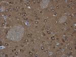WAVE1 Antibody in Immunohistochemistry (Paraffin) (IHC (P))
