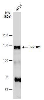 LRRFIP1 Antibody in Western Blot (WB)