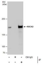 ROCK2 Antibody in Immunoprecipitation (IP)