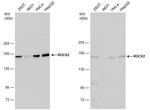 ROCK2 Antibody in Western Blot (WB)