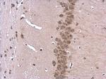 ROCK2 Antibody in Immunohistochemistry (Paraffin) (IHC (P))