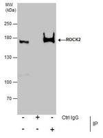 ROCK2 Antibody in Immunoprecipitation (IP)