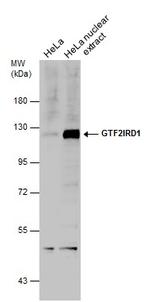 GTF2IRD1 Antibody in Western Blot (WB)
