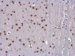 BCLAF1 Antibody in Immunohistochemistry (Paraffin) (IHC (P))