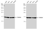 TOMM20 Antibody in Western Blot (WB)
