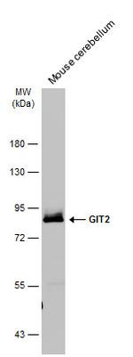GIT2 Polyclonal Antibody