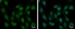 ZEB2 Polyclonal Antibody