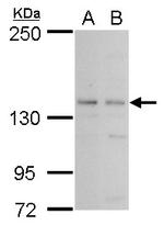 PAN2 Polyclonal Antibody