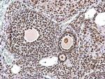 hnRNP DL Antibody in Immunohistochemistry (Paraffin) (IHC (P))
