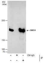 SMC4 Antibody in Immunoprecipitation (IP)